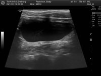 98512_Pedersen_Baby_20070301_0.jpg