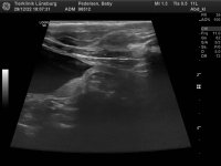 98512_Pedersen_Baby_20070301_1.jpg