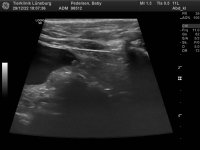 98512_Pedersen_Baby_20070301_2.jpg