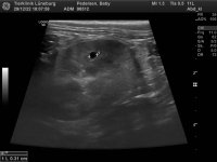 98512_Pedersen_Baby_20070301_3.jpg