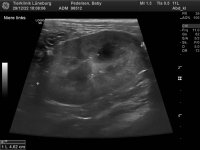 98512_Pedersen_Baby_20070301_4.jpg