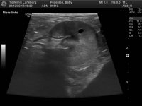 98512_Pedersen_Baby_20070301_5.jpg