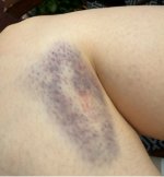 IMG_2423.jpeg